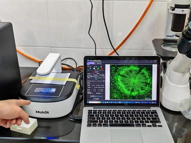 MCS21活細胞成像儀應(yīng)用于上海華山醫(yī)院活細胞觀察.jpg MCS21活細胞成像儀應(yīng)用于上海華山醫(yī)院活細胞觀察.jpg