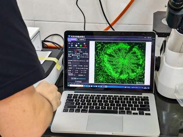 MCS21活細胞成像儀應(yīng)用于上海華山醫(yī)院活細胞觀察.jpg MCS21活細胞成像儀應(yīng)用于上海華山醫(yī)院活細胞觀察.jpg